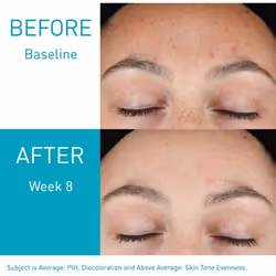 CeraVe Resurfacing Retinol Serum