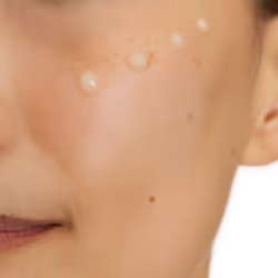 Skin Renewing 10% Pure Vitamin C Serum with Ceramides for Brighter and Smoother Skin, 30 ml