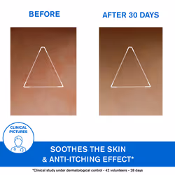 Xemose Cerato Anti-Irritation for Extra Dry Skin Prone to Atopic Eczema 200 ml - Additional view 4