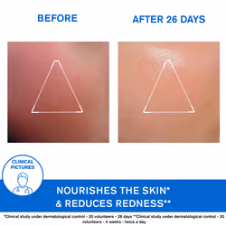 Xemose Soothing Facial Cream for Dry Skin, Prone to Atopic Eczema 40 ml - Additional view 4
