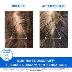 Ds Moderate Dandruff Shampoo with Piroctone Olamine - Eliminates Dry and Greasy Dandruff 200 ml - Additional view 4