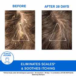 Ds Hair Shampoo for Severe Dandruff with 1.8% Lactic Acid 150 ml - Additional view 4