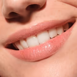 CATRICE Diamond Glaze Lip Gloss 040 Diamonds Made Me Do It - Additional view 7