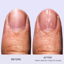 Treatment Power Duo - ProSpa Hands, Feet, Nail & Cuticle Oil & Nail Envy Strengthener Treatment - 2 x 15ml