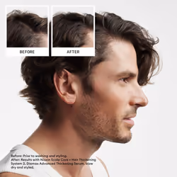 Nioxin Scalp + Hair Thickening System 2 Conditioner, For Natural Hair with Progressed Thinning, 10.1 fl oz (Packaging May Vary)