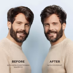 3-Part System, System 2 Natural Hair with Progressed Thinning, Hair Thickening Treatment, Sca
