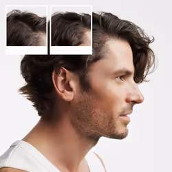 System 2 - Kit - Treatment for Natural Hair with Advanced Weakening 3 units - Additional view 4