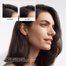 Scalp + Hair Thickening System 3 Kit - Hair Thickening System for Coloured Or Dry Damaged Hair with Light Thinning - Shampoo, Conditioner & Scalp - Additional view 5
