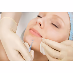 Comedone Extractor - Blackhead & Blemish Remover (White)