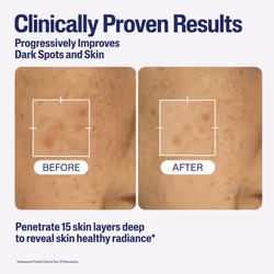 Healthy Radiance Brightening Serum with Niacinamide for Skin Pigmentation, 30ml - Additional view 4