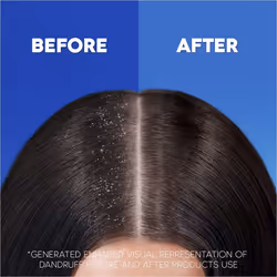 Head & Shoulders Anti-Dandruff Shampoo 2in1 Classic Clean 1000ml VALUE PACK Shampoo For Men & Women Targets Dandruff Root Cause For 100% Flake-Free