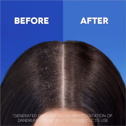 Head & Shoulders Anti-Dandruff Shampoo, 2in1 Classic Clean 1000ml Targets Dandruff Root Cause For Up To 100% Flake-Free, Clinically Proven Deep Clean