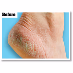 O'Keeffe's Healthy Feet, 91g, Packaging may vary