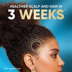 Head and Shoulders Scalp Cream Treatment, Daily Moisture, Anti Dandruff, Royal Oils Collection with Coconut Oil, Scalp Care for Natural and Curly