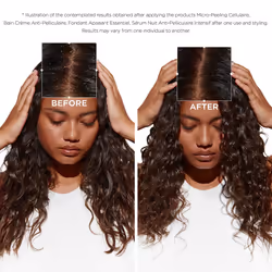 K?rastase Symbiose, Detangling Soothing Cellular Conditioner, For Sensitive, Dandruff-Prone Scalps and Fine Hair, Sulphate-Free, Silicone-Free,