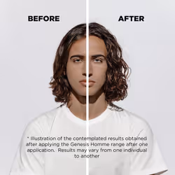 K?rastase Genesis Homme, Anti-Hair Fall Fortifying Serum, for Weakened & Thinning Hair, With Aminexil, S?rum Anti-Chute Fortifiant, 90 ml