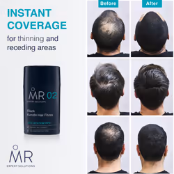 MR Dark Brown Hair Fibres (15g). Paraben Free Hair Loss Concealer with System-PPX, Thinning Hair Concealer for Bald Patch Cover Up, Hair Fibres Dark