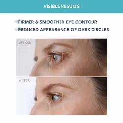 FOREO IRIS Firming Eye Serum - Retinol Serum- Mushroom Extract - Bakuchiol - Eye Cream for Dark Circles and Puffy Eyes - Dark Circles Under Eye