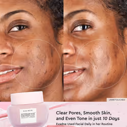 Glow Recipe Watermelon Glow Hyaluronic Clay Pore-Tight Facial - Gentle Exfoliating Clay Mask with Hyaluronic Acid - Help Minimize the Appearance of