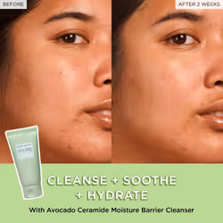 Glow Recipe Avocado Ceramide Moisture Barrier Face Cleanser - Hydrating Facial Cleanser for Dry Skin - Daily Makeup Remover & Gentle Face Wash