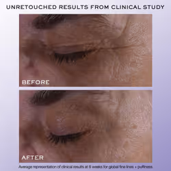 Lanc?me R?nergie H.C.F. Triple Serum Eye - Visible eye Lift effect & Reduce the look of Eye Wrinkles, With Hyaluronic Acid & Niacinamide, 20ml