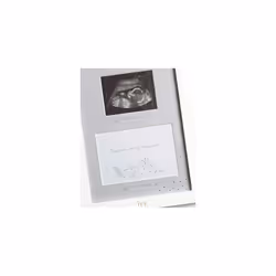 Baby Forever Treasured Double Scan Photo Frame Keepsake Gift, Cream