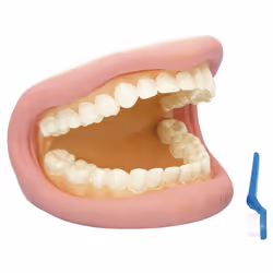Rapid Giant Teeth Demonstration Model - 150 x 185 x 140mm