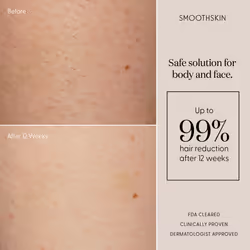IPL Hair Removal SmoothSkin Pure Fit Epilator for Women&Men Body&Face