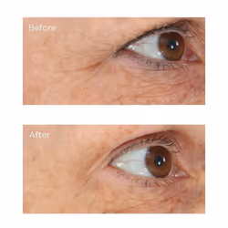 Perricone MD Essential Fx Acyl-Glutathione: Eyelid Lift eye serum 15 ml Women - Additional view 5