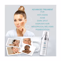 DB Bright Skin Dark Spot Corrector, Reduce Hyperpigmentation, Acne, Sun damage, Menopausal Melasma & Freckles - with Arbutin, Niacinamide & Vitamin E