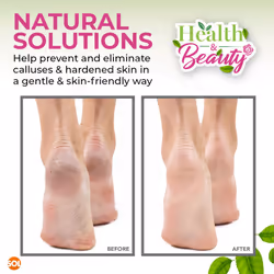 2pk Natural Pumice Stone for Feet - Callus Remover & Scrubber