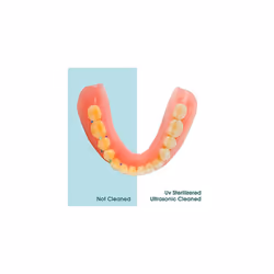 Hangsun Ultrasonic UV Cleaner Machine for Dentures, Aligner, Retainer, Whitening Trays, Mouthguards, Ultrasonic Cleaner Machine for All Dent