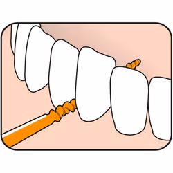 TePe Easy Pick Interdental Brush, Orange, Size: XS/S , Pack of 1 x 36