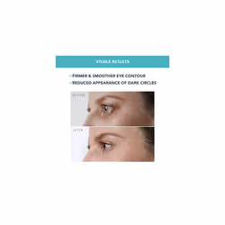 IRIS Firming Eye Serum - Retinol Serum- Mushroom Extract - Bakuchiol - Eye Cream for Dark Circles and Puffy Eyes - Dark Circles Under Eye Treatment -