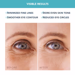 IRIS Under Eye Patches - Dark Circles Under Eye Treatment Women & Men - Eye Patches Skincare - Hydrating Gel Eye Mask - Collagen - Vitamin C & Vitamin
