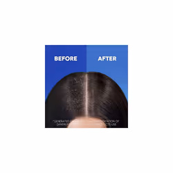 Head And Shoulders Anti Dandruff Shampoo Apple, Clarifying Shampoo For Up To 100% Dandruff Protection, Dry Scalp Shampoo For Hair & Itchy Scalp