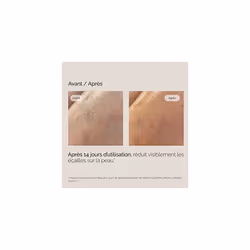 Ureadin Ultra 10 Repairing Lotion Plus | Intense Hydration | 10% Urea Isdin & Dexpanthenol 400ml - Additional view 6