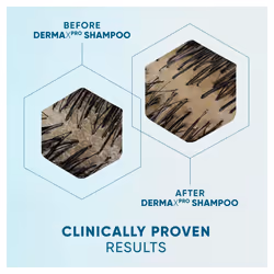 Anti-Dandruff DermaX Pro Shampoo and Conditioner Set with Hair Growth Serum. For Dry Scalp and Thinning Hair to Revitalise Scalp and Strengthen Hair