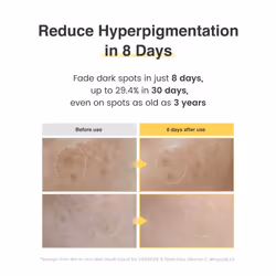 VARIHOPE 8 Days Vitamin C Serum (0.5oz) - Facial Serum for Dark Spots with Pure Face Ampoule. Korean Brightening  Glowing Skin Care.