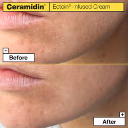 Dr.Jart+ Ceramidin Ectoin-Infused Cream 50ml - Additional view 4