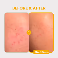 TIRTIR PURE VITAMIN C 24% SERUM 30ml - Additional view 4