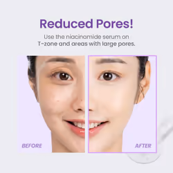 TIRTIR Niacinamide 20% Serum 30ml - Additional view 4