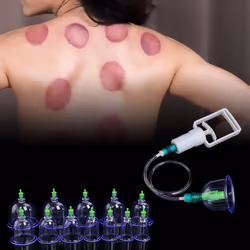 Vacuum Therapy Massage Cups Set - 12 Cups & Suction Pump