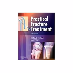 ISBN Practical Fracture Treatment 5e, Health, mind & body, English, 456 pages