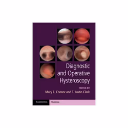 Diagnostic and Operative Hysteroscopy by Edited by Mary Connor & Edited by Justin Clark