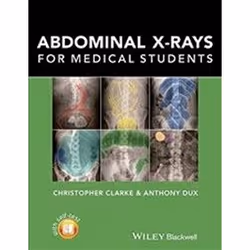 ISBN Abdominal X-Rays for Medical Students, Educational, English, 128 pages