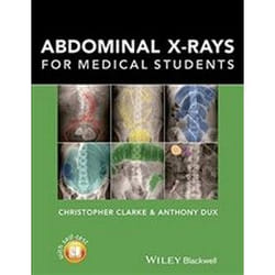 ISBN Abdominal X-Rays for Medical Students book Educational English 128 pages