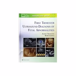 ISBN First Trimester Ultrasound Diagnosis of Fetal Abnormalities, Health, mind & body, English, Hardcover, 384 pages