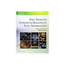 ISBN First Trimester Ultrasound Diagnosis of Fetal Abnormalities book Health, mind & body English Hardcover 384 pages