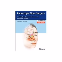 ISBN Endoscopic Sinus Surgery: Anatomy, Three-Dimensional Reconstruction, and Surgical Technique, Health, mind & body, Englis ...